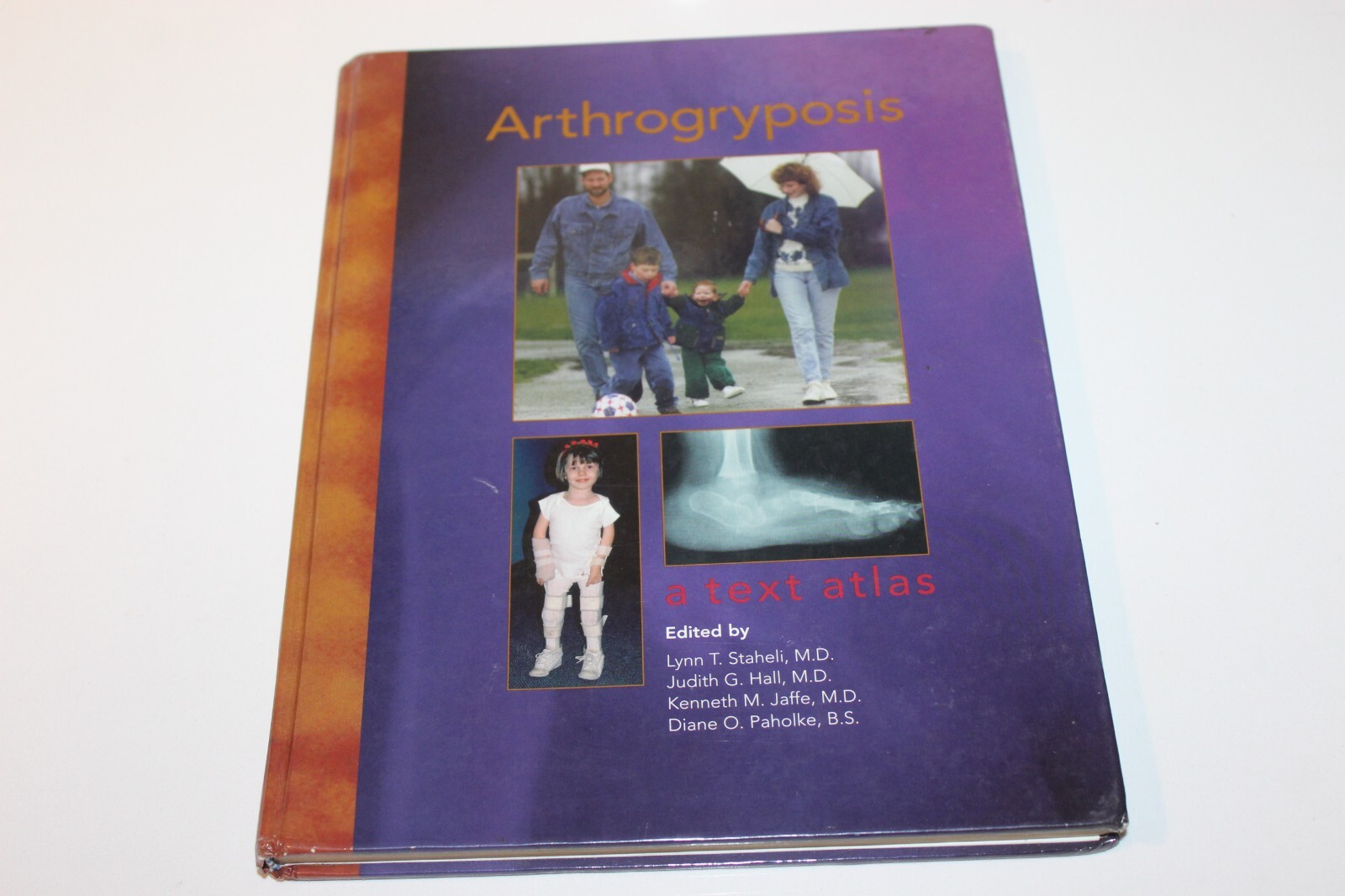 Arthrogryposis: A Text Atlas HC Cambridge University Press VG