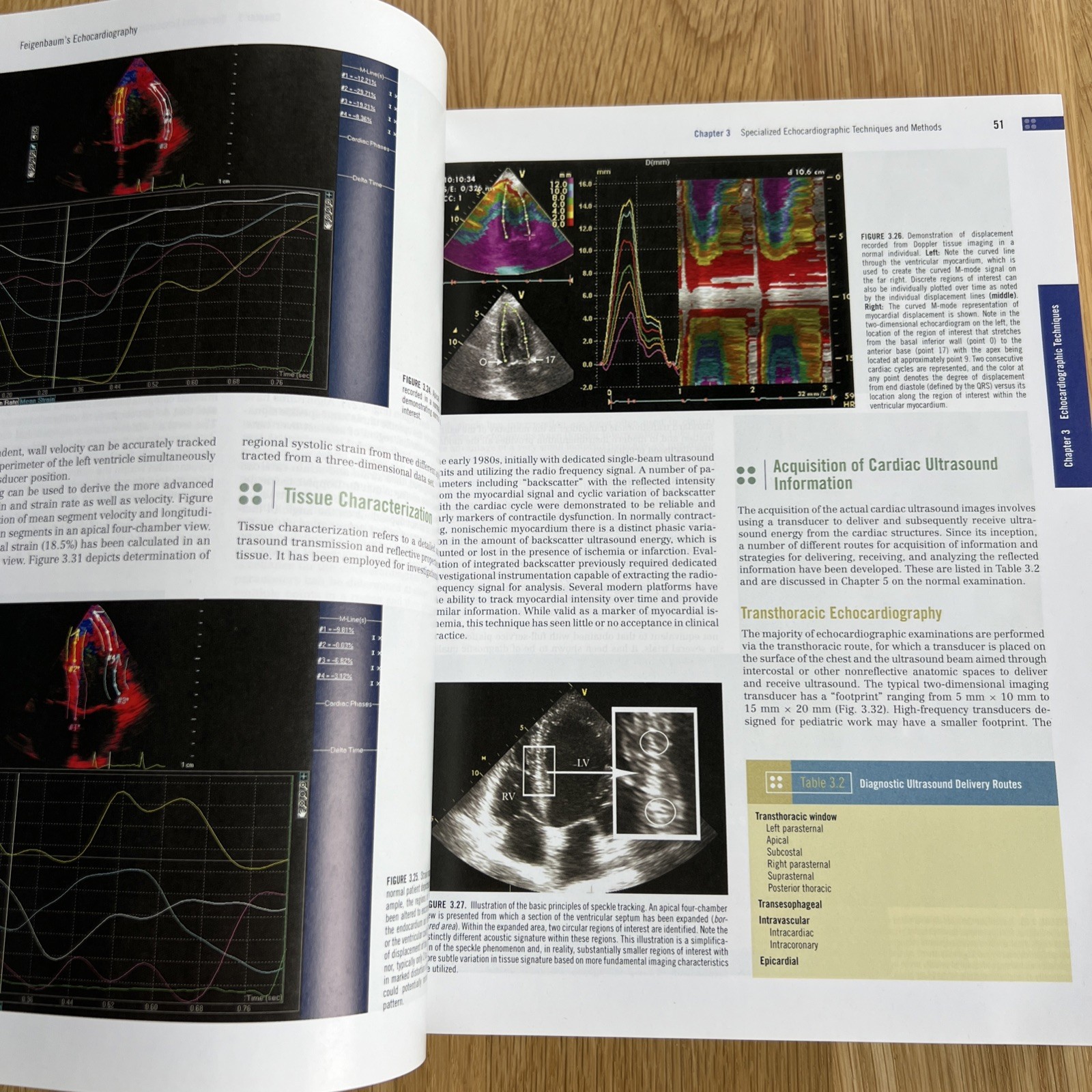 Feigenbaum’s Echocardiography by Thomas Ryan and William F. Armstrong (2009,…