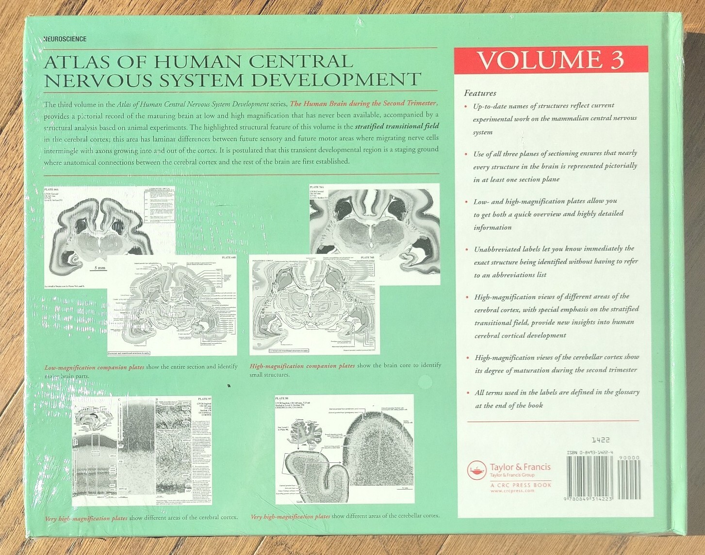 Human Brain During the Second Trimester, Hardcover by Bayer, Shirley. Sealed New