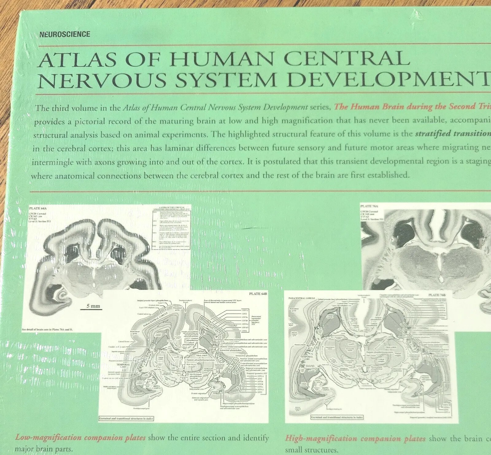 Human Brain During the Second Trimester, Hardcover by Bayer, Shirley. Sealed New