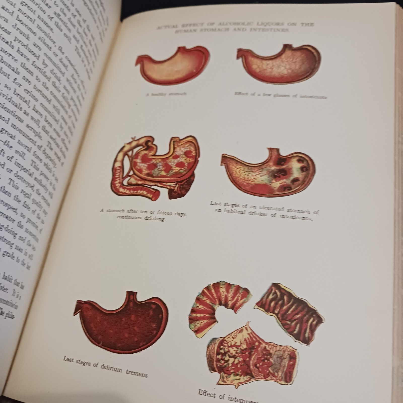 Antique Library of Health Medical Book, 1925 with Color Plates, Some Interactive