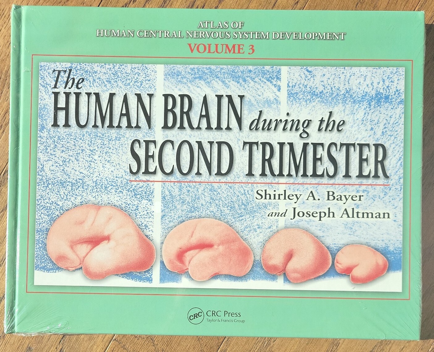 Human Brain During the Second Trimester, Hardcover by Bayer, Shirley. Sealed New