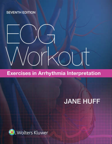 ECG Workout: Exercises in Arrhythmia Interpretation – Paperback – VERY GOOD