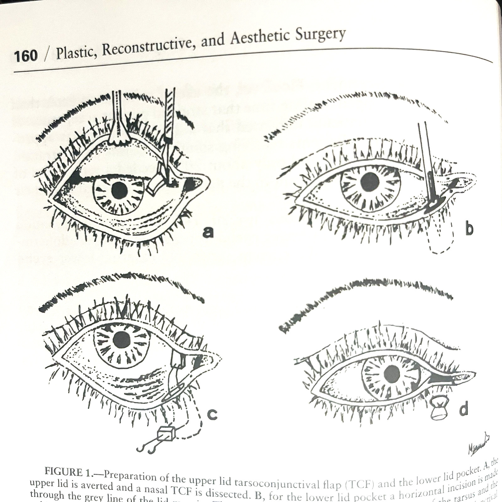 Vintage Year Book of Plastic, Reconstructive and Aesthetic Surgery Book 1998