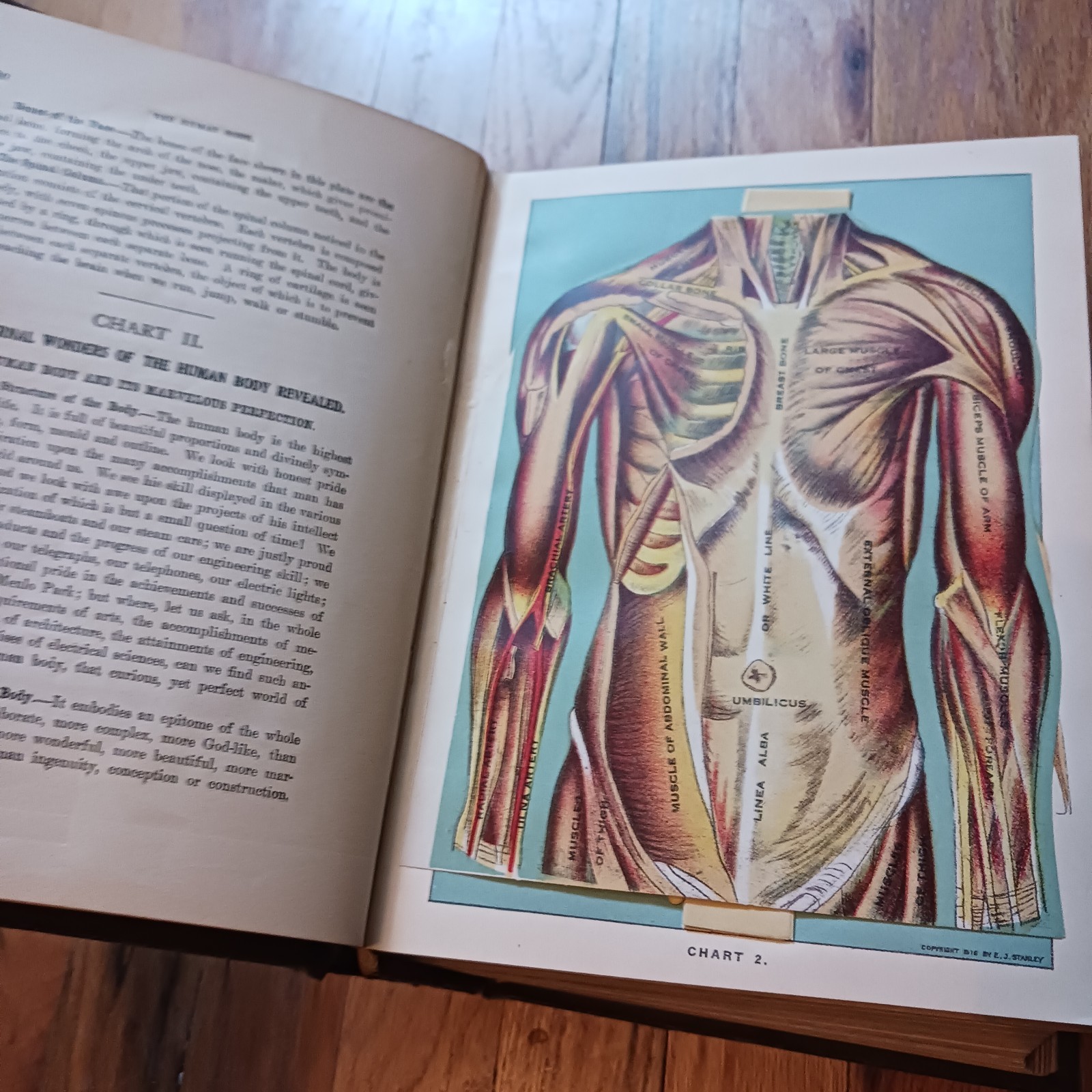 Antique Library of Health Medical Book, 1925 with Color Plates, Some Interactive