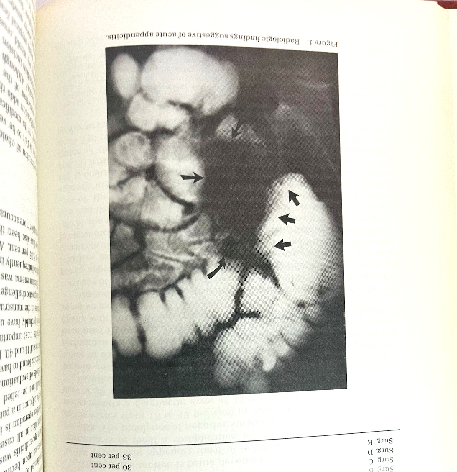 Organ Transplantation The Surgical Clinics of North America Lot of 2 Books 1976