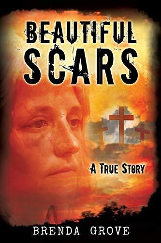 BEAUTIFUL SCARS