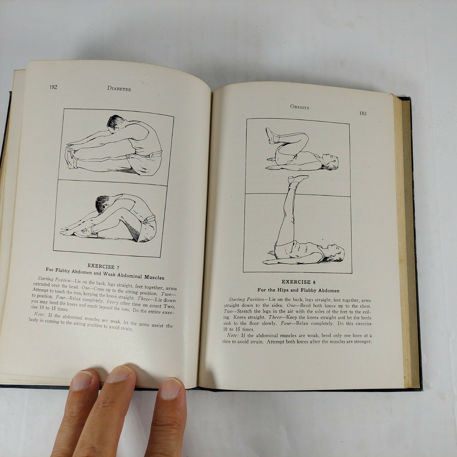 Diabetes 3rd Ed. Revised & Illustrated, 1944 by Edward Bortz HC Ex-Library