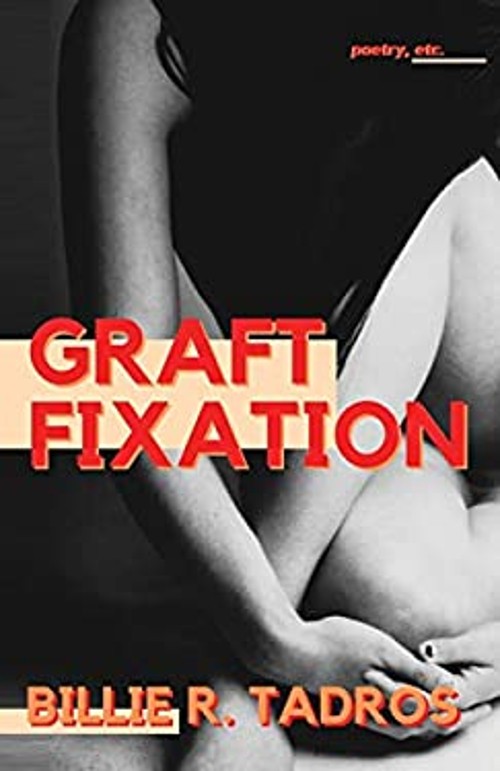 Graft Fixation Paperback Billie Tadros