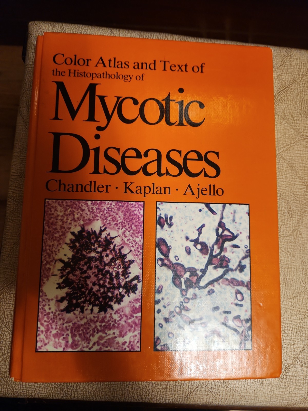Color Atlas and Text of Histopathology of Mycotic Diseases by Chandler, Kaplan,