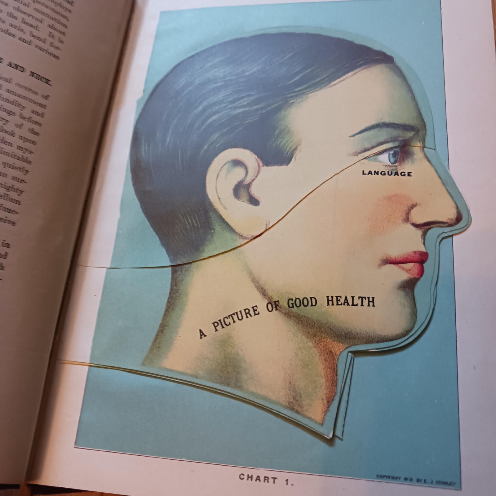 Antique Library of Health Medical Book, 1925 with Color Plates, Some Interactive