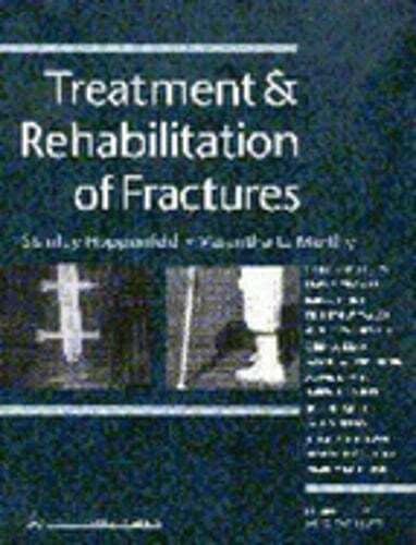 Treatment and Rehabilitation of Fractures by Hoppenfeld: Used