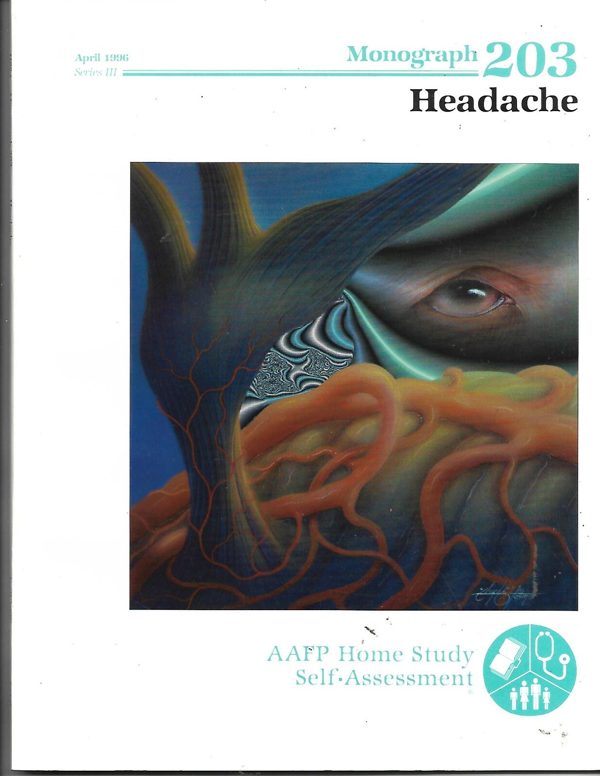 Headache by Robert Smith, MD, 1996, AAFP Monograph, 45 pages